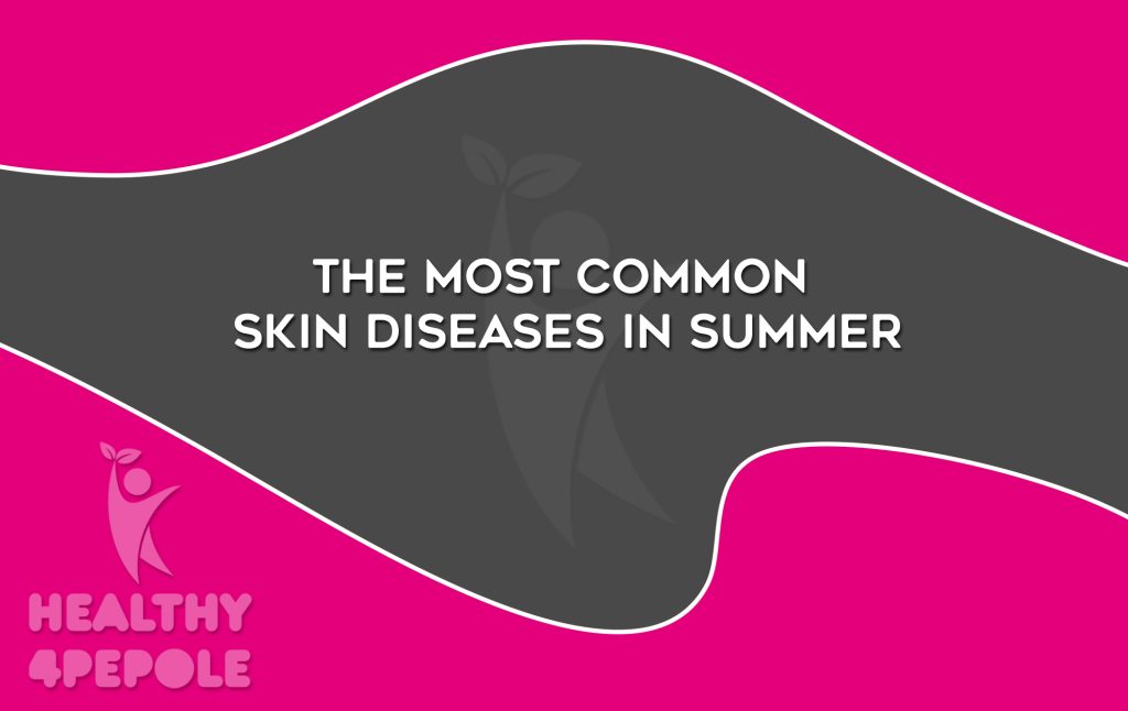 The most common skin diseases in summer