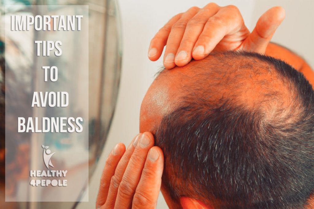 Important Tips to Avoid Baldness