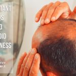 Important Tips to Avoid Baldness